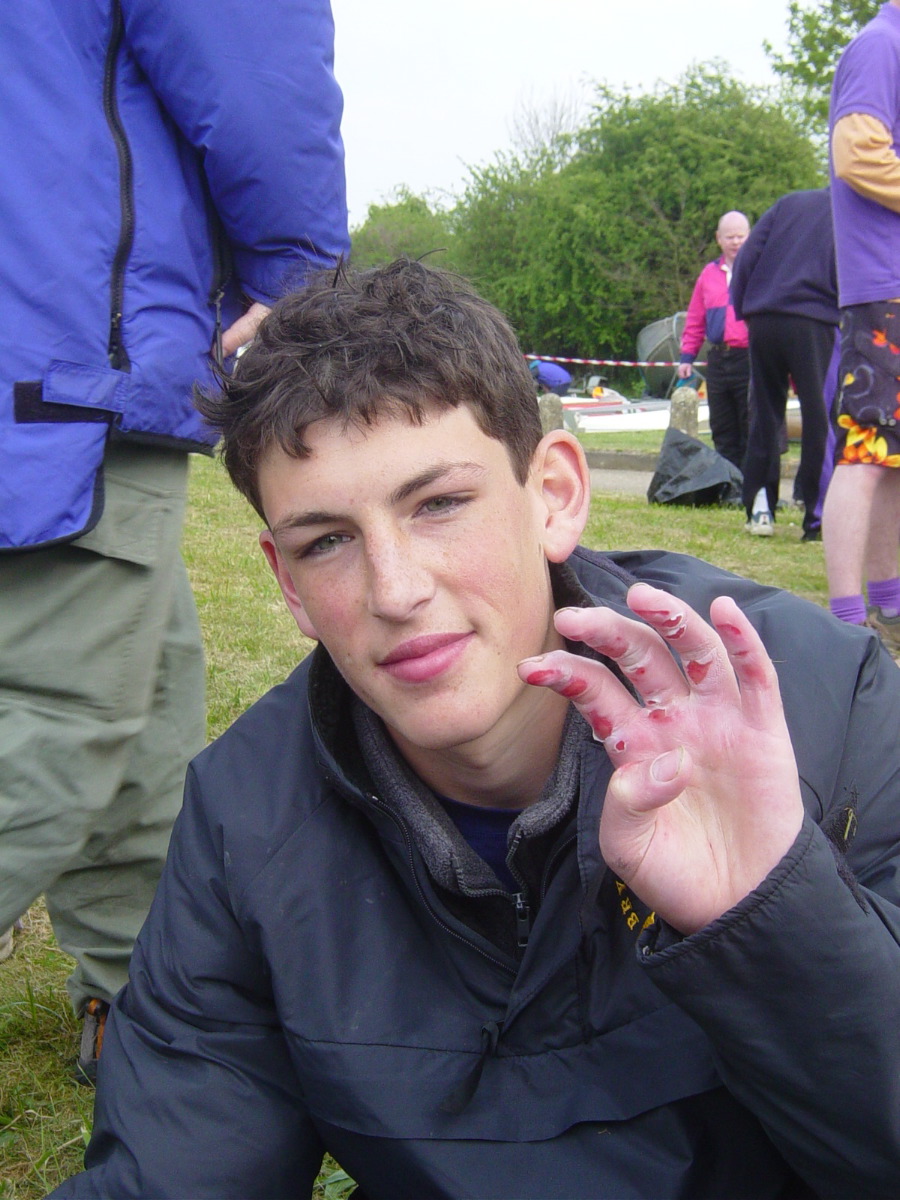 bilbo all bloody